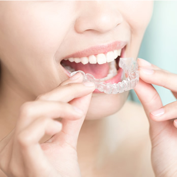 治療開始のイメージ